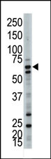 The anti-UBQLN3 Pab (Cat. #AP12099PU-N) is used in Western blot to detect UBQLN3 in mouse cerebellum tissue lysate.