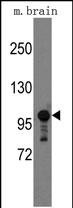 Western blot analysis of mouse anti-Semaphorin 5A Pab (Cat.#AP12325PU-N) in mouse brain tissue lysates (35ug/lane). Semaphorin 5A(arrow) was detected using the purified Pab.