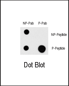 Dot blot analysis of Phospho-MAP3K1-T1383 Pab (Cat.AP12773PU-N) on nitrocellulose membrane. 50ng of Phospho-peptide or Non Phospho-peptide per dot were adsorbed. Antibody working concentration were 0.5ug per ml.