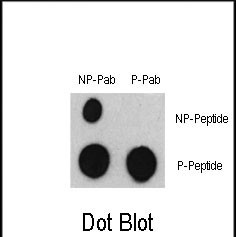 Dot blot analysis of Phospho-ATF2-S322 Antibody (Cat. #AP12808PU-N) and ATF2 Non Phospho-specific Pab on nitrocellulose membrane. 50ng of Phospho-peptide or Non Phospho-peptide per dot were adsorbed. Antibody working concentrations are 0.5ug per ml.