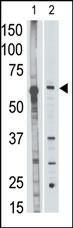 The anti-MMP25 C-term Antibody (Cat.#AP13179PU-N) is used in Western blot to detect  MMP25 in mouse liver tissue lysate (lane 1) and HL60 cell lysate (lane 2) lysate.