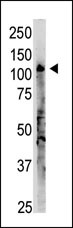 The anti-OAS3 C-term Antibody (Cat.#AP13202PU-N) is used in Western blot to detect  OAS3 in A375  lysate.