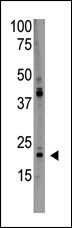 The anti-PDAP1 Antibody (C-term)(Cat.#AP13232PU-N) is used in Western blot to detect  PDAP1 in HL60 lysate.