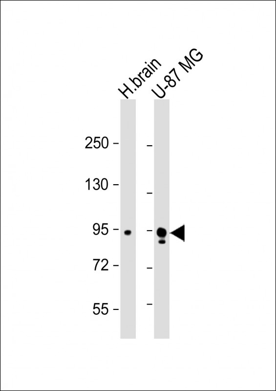 All lanes : Anti-Synphilin-1 (C-term) at 1:1000 dilution
Lane 1: human brain lysate
Lane 2: U-87 MG whole cell lysate


Lysates/proteins at 20 µg per lane. 

Secondary
Goat Anti-Rabbit IgG,  (H+L), Peroxidase conjugated at 1/10000 dilution. 

Predicted band size : 100 kDa

Blocking/Dilution buffer: 5% NFDM/TBST.