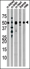 The anti-Drosophila Parkin Pab (Cat. #AP13497PU-N) is used in Western blot to detect Drosophila Parkin in, from left to right, mouse kidney, mouse brain, mouse heart, Ramos, and Hela tissue lysates.