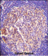GRK6 Antibody (C-term) (Cat. #AP7008A)immunohistochemistry analysis in formalin fixed and paraffin embedded human tonsil tissue followed by peroxidase conjugation of the secondary antibody and DAB staining.This data demonstrates the use of GRK6 Antibody (C-term) for immunohistochemistry.  Clinical relevance has not been evaluated.