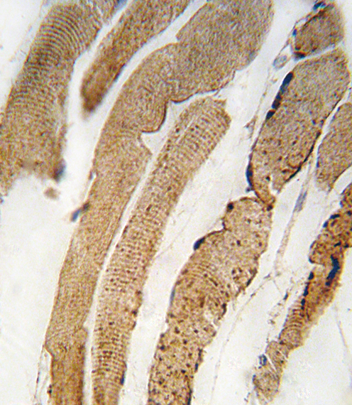 Formalin-fixed and paraffin-embedded human skeletal muscle tissue reacted with PDK4 antibody (Center D98) (Cat.#AP7041f), which was peroxidase-conjugated to the secondary antibody, followed by DAB staining. This data demonstrates the use of this antibody for immunohistochemistry; clinical relevance has not been evaluated.