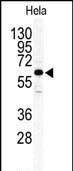 Western blot analysis of anti-ILK2/ILK1 Antibody (C-term)(Cat.#AP13652PU-N) in Hela cell line lysates (35ug/lane). ILK2(arrow) was detected using the purified Pab.