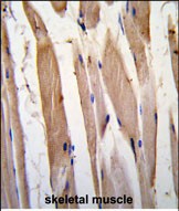Formalin-fixed and paraffin-embedded human skeletal muscle tissue reacted with VINC antibody (N-term) , which was peroxidase-conjugated to the secondary antibody, followed by DAB staining. This data demonstrates the use of this antibody for immunohistochemistry; clinical relevance has not been evaluated.