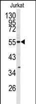 Western blot analysis of CDK8 antibody (N-term) (Cat.# AP14153PU-N) in Jurkat cell line lysates (35ug/lane). CDK8 (arrow) was detected using the purified Pab.