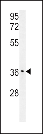 IGFBP3-S183(Cat.#AP7641d) western blot analysis in mouse stomach tissue lysates (15ug/lane).This demonstrates the IGFBP antibody detected IGFBP protein (arrow).