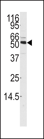 Western blot analysis of anti-CAMKK1 Antibody (Center) (Cat.#AP14557PU-N) in mouse thymus tissue lysates (35ug/lane). CAMKK1 (arrow) was detected using the purified Pab.