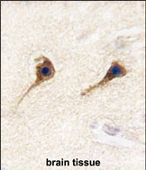 Formalin-fixed and paraffin-embedded human brain tissue reacted with SARS2 antibody (N-term) (Cat.#AP7837a), which was peroxidase-conjugated to the secondary antibody, followed by DAB staining. This data demonstrates the use of this antibody for immunohistochemistry; clinical relevance has not been evaluated.