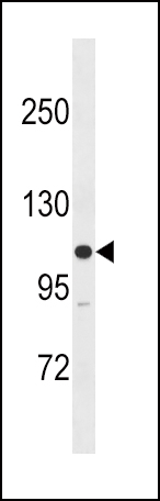 MLCK Antibody (M1) (Cat. #AP14867PU-N) western blot analysis in SK-BR-3 cell line lysates (35ug/lane).This demonstrates the MLCK antibody detected the MLCK protein (arrow).