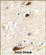 Formalin-fixed and paraffin-embedded human brain tissue reacted with PIP5K1B antibody (N-term) (Cat.# AP8038a), which was peroxidase-conjugated to the secondary antibody, followed by DAB staining. This data demonstrates the use of this antibody for immunohistochemistry; clinical relevance has not been evaluated.