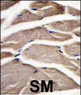 Formalin-fixed and paraffin-embedded human skeletal muscle reacted with PFKM Antibody (C-term)(Cat.#AP15117PU-N), which was peroxidase-conjugated to the secondary antibody, followed by DAB staining. This data demonstrates the use of this antibody for immunohistochemistry; clinical relevance has not been evaluated.