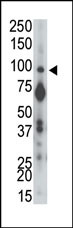 The anti-PTPalpha N-term Pab (Cat. #AP15220PU-N) is used in Western blot to detect PTPalpha in mouse brain tissue lysate.