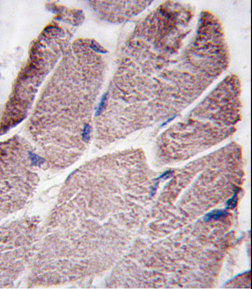 Formalin-fixed and paraffin-embedded human skeletal muscle tissue reacted with PTPD1 antibody (Center), which was peroxidase-conjugated to the secondary antibody, followed by DAB staining. This data demonstrates the use of this antibody for immunohistochemistry; clinical relevance has not been evaluated.