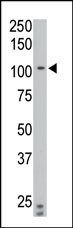 The anti-PTPIA2 beta N-term Pab (Cat. #AP15236PU-N) is used in Western blot to detect PTPIA2 beta in C6 cell lysate.