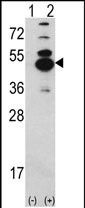 Western blot analysis of CAMK1D (arrow) using rabbit polyclonal CAMK1D Antibody (N-term) (Cat. #AP17173PU-N). 293 cell lysates (2 ug/lane) either nontransfected (Lane 1) or transiently transfected with the CAMK1D gene (Lane 2).