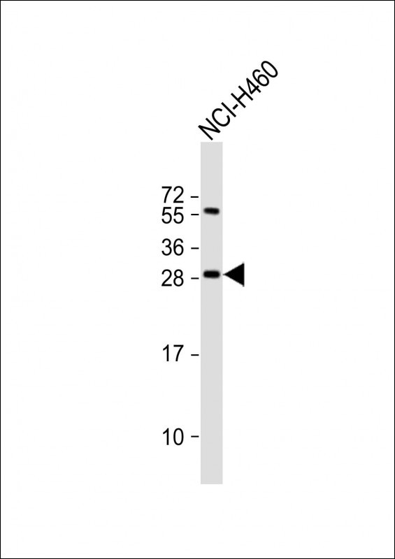 Anti-FGF18 Antibody (N-term) at 1:2000 dilution + NCI-H460 whole cell lysate

Lysates/proteins at 20 µg per lane. 

Secondary
Goat Anti-Rabbit IgG,  (H+L), Peroxidase conjugated at 1/10000 dilution. 

Predicted band size : 24 kDa

Blocking/Dilution buffer: 5% NFDM/TBST.