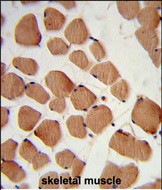 Formalin-fixed and paraffin-embedded human skeletal muscle reacted with PHYH2 Antibody (C-term), which was peroxidase-conjugated to the secondary antibody, followed by DAB staining. This data demonstrates the use of this antibody for immunohistochemistry; clinical relevance has not been evaluated.