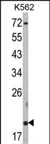 Western blot analysis of RNF5 Antibody (N-term) (Cat. #AP18182PU-N) in K562 cell line lysates (35ug/lane). RNF5 (arrow) was detected using the purified Pab.