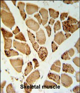 5NT1A Antibody (N-term) (Cat. #AP9917a) IHC analysis in formalin fixed and paraffin embedded skeletal muscle followed by peroxidase conjugation of the secondary antibody and DAB staining.  This data demonstrates the use of the 5NT1A Antibody (N-term) for immunohistochemistry.  Clinical relevance has not been evaluated.