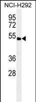 ABHD8 Antibody  (C-term) (Cat. #AP50027PU-N) western blot analysis in NCI-H292 cell line lysates (35ug/lane).This demonstrates the ABHD8 antibody detected the ABHD8 protein (arrow).