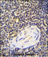 ACAP1 Antibody (N-term) (Cat. #AP50038PU-N)immunohistochemistry analysis in formalin fixed and paraffin embedded human spleen tissue followed by peroxidase conjugation of the secondary antibody and DAB staining.This data demonstrates the use of ACAP1 Antibody (N-term) for immunohistochemistry.  Clinical relevance has not been evaluated.