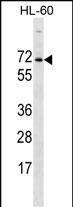 ACPL2 Antibody (Center) (Cat. #AP50057PU-N) western blot analysis in HL-60 cell line lysates (35ug/lane).This demonstrates the ACPL2 antibody detected the ACPL2 protein (arrow).
