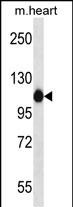 ACTN2 Antibody (C-term) (Cat. #AP50071PU-N) western blot analysis in mouse heart tissue lysates (35ug/lane).This demonstrates the ACTN2 antibody detected the ACTN2 protein (arrow).