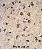 Formalin-fixed and paraffin-embedded human brain tissue reacted with ADRBK2 Antibody (N-term), which was peroxidase-conjugated to the secondary antibody, followed by DAB staining. This data demonstrates the use of this antibody for immunohistochemistry; clinical relevance has not been evaluated.