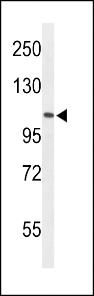 Western blot analysis of AF5q31 Antibody (N-term) (Cat. #AP50103PU-N) in HL-60 cell line lysates (35ug/lane). AF5q31 (arrow) was detected using the purified Pab.