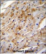 ALDH1L2 Antibody (C-term) (Cat. #AP50141PU-N)immunohistochemistry analysis in formalin fixed and paraffin embedded mouse heart tissue followed by peroxidase conjugation of the secondary antibody and DAB staining.This data demonstrates the use of ALDH1L2 Antibody (C-term) for immunohistochemistry.  Clinical relevance has not been evaluated.