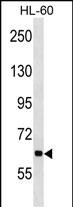 ANKHD1 Antibody (N-term) (Cat. #AP16216a) western blot analysis in HL-60 cell line lysates (35ug/lane).This demonstrates the ANKHD1 antibody detected the ANKHD1 protein (arrow).