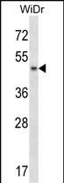 ANKS4B Antibody (Center) (Cat. #AP14720c) western blot analysis in WiDr cell line lysates (35ug/lane).This demonstrates the ANKS4B antibody detected the ANKS4B protein (arrow).