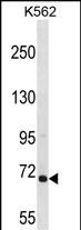 ARHGEF6 Antibody (C-term) (Cat. #AP50239PU-N) western blot analysis in K562 cell line lysates (35ug/lane).This demonstrates the ARHGEF6 antibody detected the ARHGEF6 protein (arrow).
