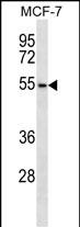 ARMCX1 Antibody (Center) (Cat. #AP50249PU-N) western blot analysis in MCF-7 cell line lysates (35ug/lane).This demonstrates the ARMCX1 antibody detected the ARMCX1 protein (arrow).