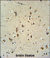 ATPGD1 antibody (N-term) (Cat. #AP50310PU-N) immunohistochemistry analysis in formalin fixed and paraffin embedded human brain tissue followed by peroxidase conjugation of the secondary antibody and DAB staining.  This data demonstrates the use of the ATPGD1 antibody (N-term) for immunohistochemistry.  Clinical relevance has not been evaluated.