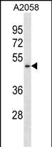 BFAR Antibody (N-term) (Cat. #AP50370PU-N) western blot analysis in A2058 cell line lysates (35ug/lane).This demonstrates the BFAR antibody detected the BFAR protein (arrow).