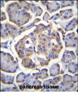 BTBD17 Antibody (C-term) (Cat. #AP50400PU-N)immunohistochemistry analysis in formalin fixed and paraffin embedded human pancreas tissue followed by peroxidase conjugation of the secondary antibody and DAB staining.This data demonstrates the use of BTBD17 Antibody (C-term) for immunohistochemistry.  Clinical relevance has not been evaluated.