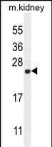 CALML4 Antibody (C-term) (Cat. #AP50715PU-N) western blot analysis in mouse kidney tissue lysates (35ug/lane).This demonstrates the CALML4 antibody detected the CALML4 protein (arrow).