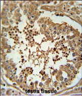 CC058 Antibody (Center) (Cat. #AP50748PU-N) immunohistochemistry analysis in formalin fixed and paraffin embedded human testis tissue followed by peroxidase conjugation of the secondary antibody and DAB staining.  This data demonstrates the use of the CC058 Antibody (Center) for immunohistochemistry.  Clinical relevance has not been evaluated.