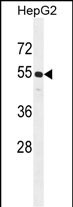 CCNJL Antibody (Center) (Cat. #AP50819PU-N) western blot analysis in HepG2 cell line lysates (35ug/lane).This demonstrates the CCNJL antibody detected the CCNJL protein (arrow).