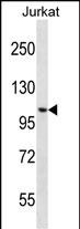 CENPC1 Antibody (Center) (Cat. #AP50853PU-N) western blot analysis in Jurkat cell line lysates (35ug/lane).This demonstrates the CENPC1 antibody detected the CENPC1 protein (arrow).