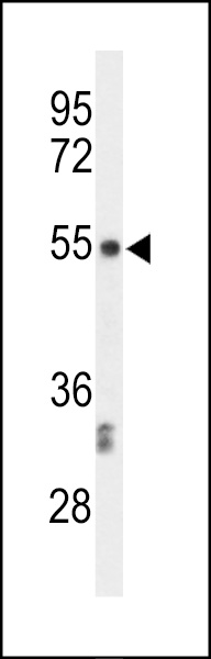 Western blot analysis of CENPI Antibody (Center) (Cat. #AP50855PU-N) in CEM cell line lysates (35ug/lane). CENPI (arrow) was detected using the purified Pab.