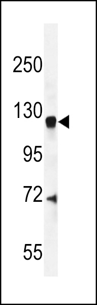 CENTG1 Antibody (C-term) (Cat. #AP50861PU-N) western blot analysis in mouse brain tissue lysates (35ug/lane).This demonstrates the CENTG1 antibody detected the CENTG1 protein (arrow).