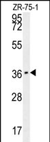 CLEC12A Antibody (Center) (Cat. #AP50957PU-N) western blot analysis in ZR-75-1 cell line lysates (35ug/lane).This demonstrates the CLEC12A antibody detected the CLEC12A protein (arrow).