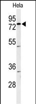 Western blot analysis of CLPTM1 Antibody (Center) (Cat. #AP50973PU-N) in Hela cell line lysates (35ug/lane). CLPTM1 (arrow) was detected using the purified Pab.